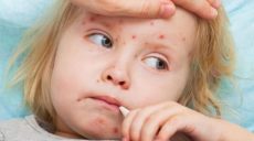 В Закарпатской области 5-летняя девочка умерла от кори