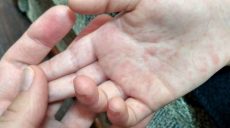 Областная детская больница в Харькове закрыта на карантин (ВИДЕО)