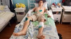 Мужчина, которого покусали собаки в Дергачах, не чувствует рук (фото)