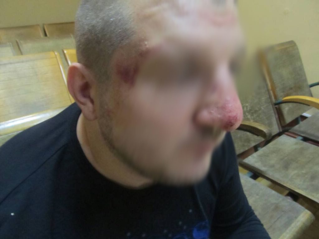 Харьковская полиция выясняет факт избиения пограничниками РФ гражданина Украины