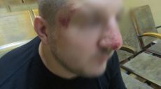 Харьковская полиция выясняет факт избиения пограничниками РФ гражданина Украины