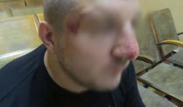 Харьковская полиция выясняет факт избиения пограничниками РФ гражданина Украины