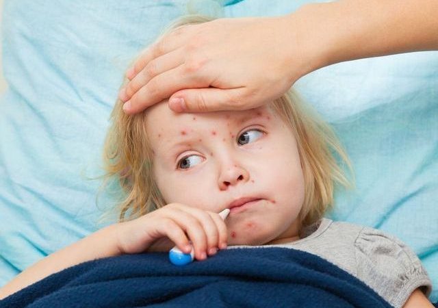 В Харькове еще два человека заболели корью