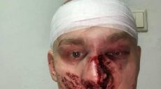 В Харькове побили Олега Ширяева (фото)