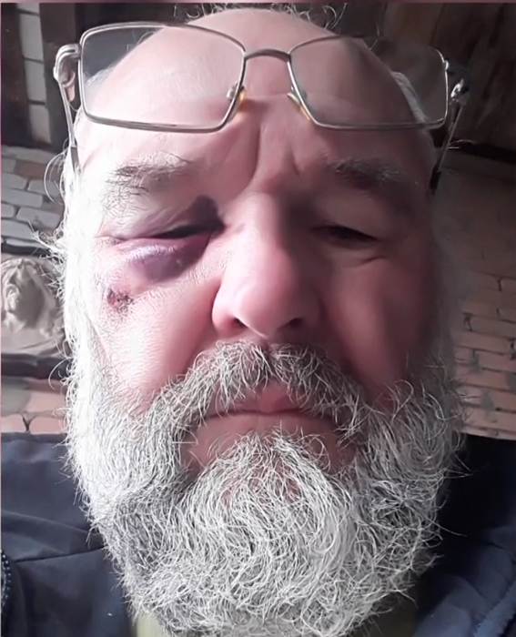 У Харкові троє зловмисників побили священнослужителя (відео)