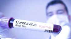 В Киеве еще 4 больных Covid-19