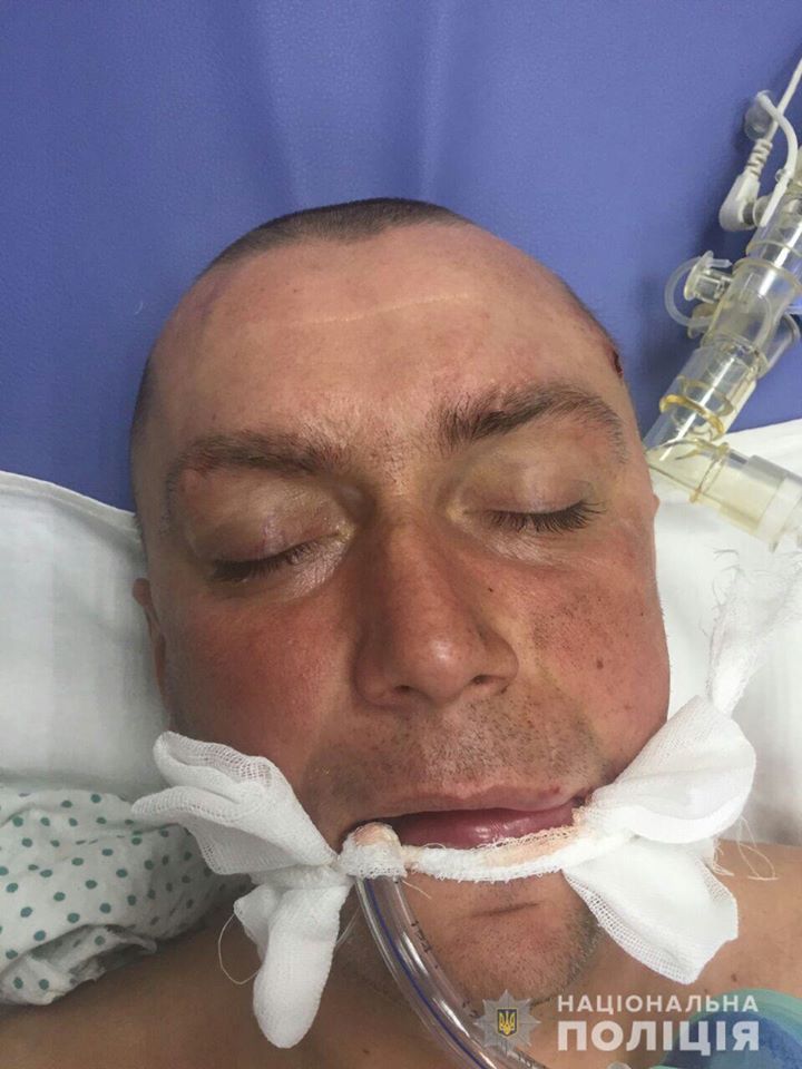 Полиция просит граждан помочь в установлении личности мужчины, который впал в кому (фото)
