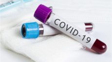 Число подтвержденных случаев инфицирования коронавирусом превысило 400 000