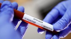 МОЗ України шукає можливість перевіряти медиків на COVID-19 що 5 днів