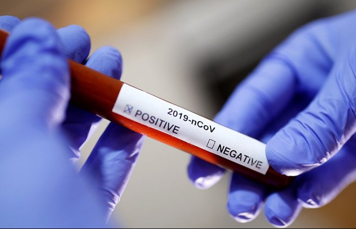 МОЗ України шукає можливість перевіряти медиків на COVID-19 що 5 днів