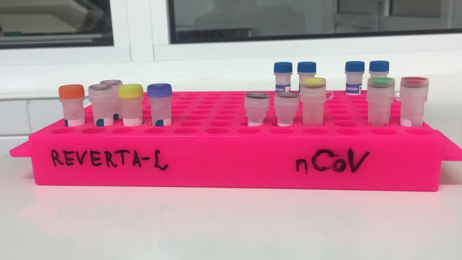 На Харьковщине провели около 100 ПЦР-исследований и более сотни экспресс-тестов