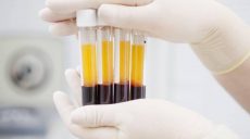 В Харьковской области будут собирать плазму крови переболевших коронавирусом
