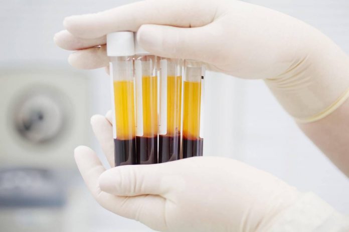 В Харьковской области будут собирать плазму крови переболевших коронавирусом
