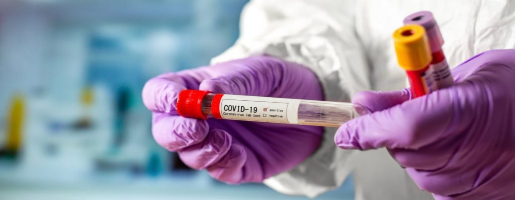 В Харьковской области зафиксировано 788 больных и 29 смертей от коронавируса