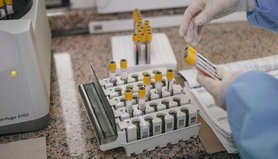 В Харьковском лабораторном центре Минздрава у 10 сотрудников подтвержден коронавирус
