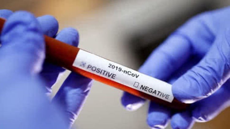 В Великобритании вакцину против коронавируса испытали на людях