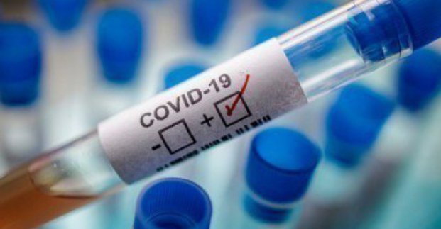 Во всем мире COVID-19 заболели около 20 миллионов людей
