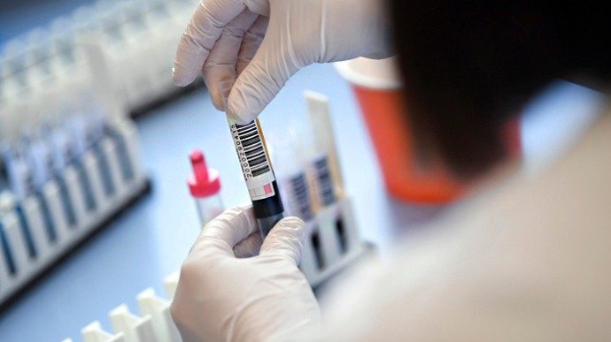 На Харьковщине зафиксировали 123 новых случая заболевания коронавирусом