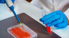 Больница должна бесплатно делать ИФА-тест при плановой госпитализации пациента, — Степанов