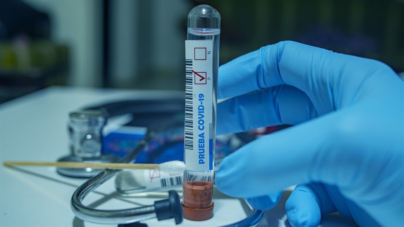 209 нових випадків коронавірусу за добу на Харківщині — лабцентр (інфографіка)