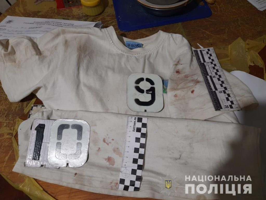 Парень 14-ти лет ударил своего отца ножом в Харьковской области (фото)