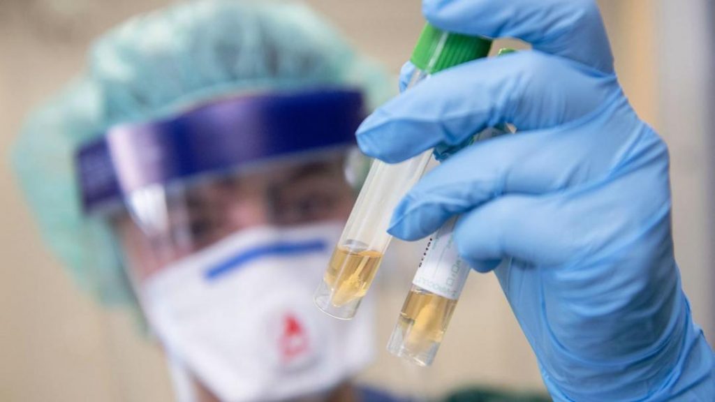 Украинская вакцина против коронавируса прошла доклиническую фазу исследования — Офис президента