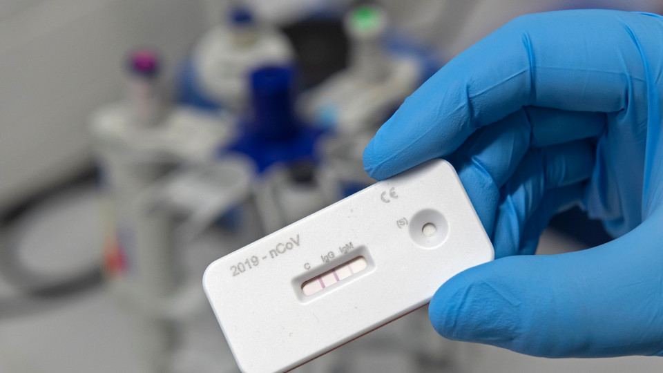 В МОЗ рассказали о возможности сделать тест на коронавирус бесплатно в частных лабораториях
