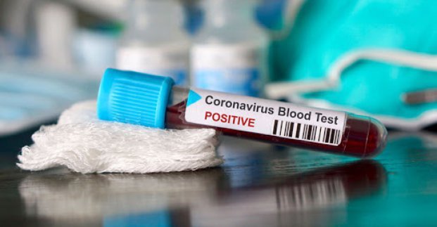 В Харькове — 32 новых случая заболевания коронавирусом