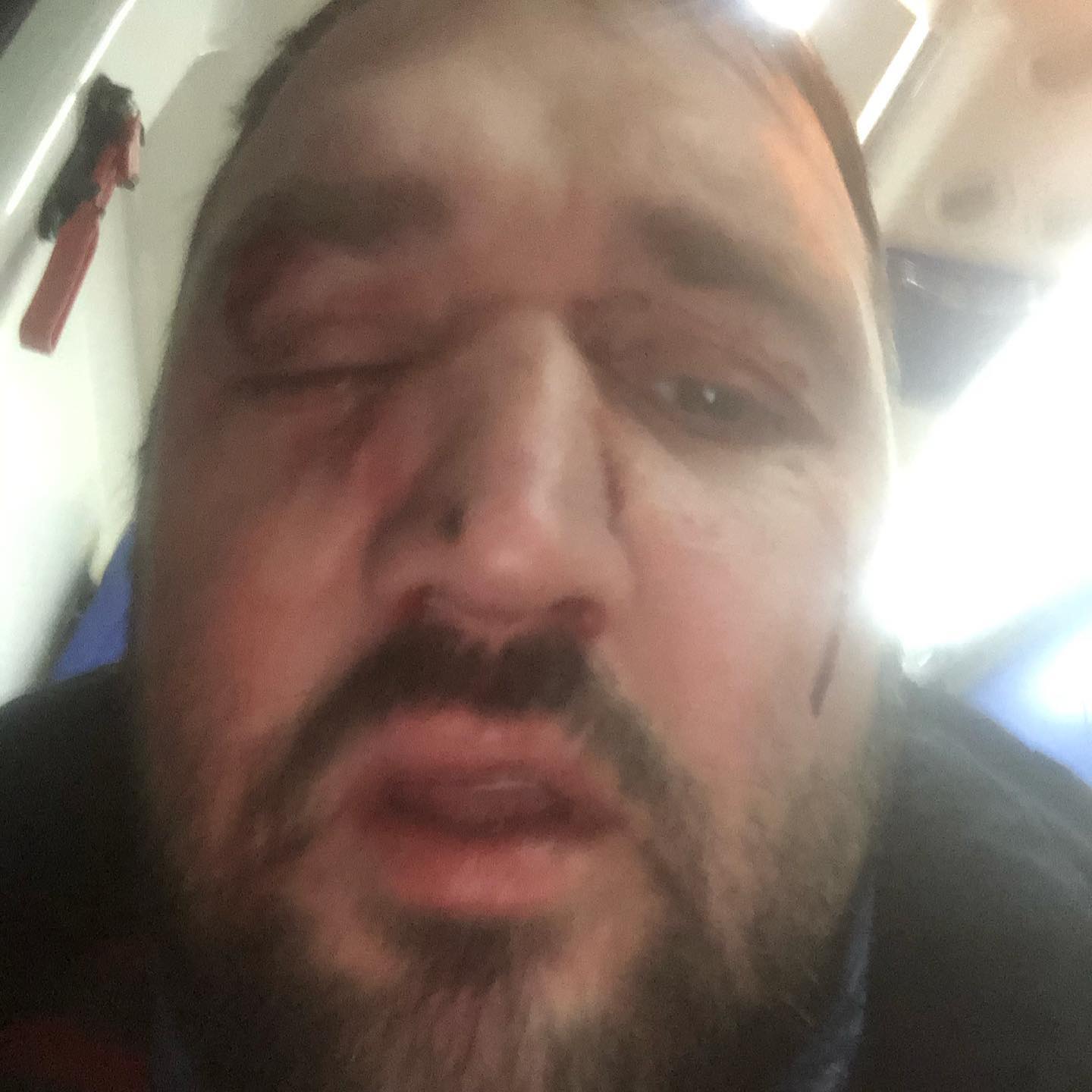 Нападение на харьковского журналиста: полиция открыла уголовное дело (фото)