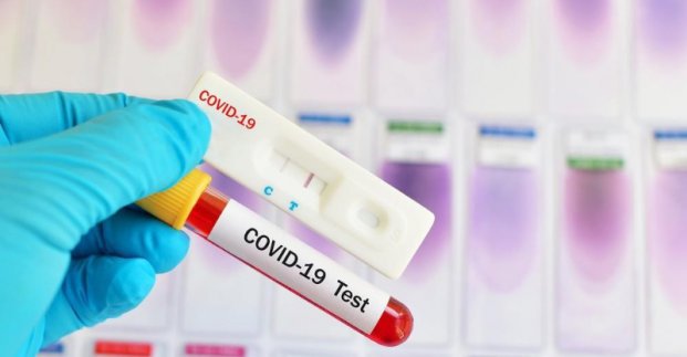 В Харькове – 5 новых случаев заболевания коронавирусом