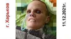 В больницу Харькова попала неизвестная женщина (фото, приметы)