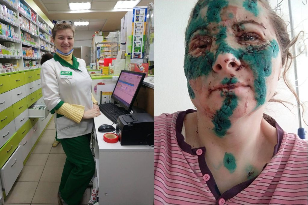 В Харькове фармацевт на рабочем месте получила серьезные ранения во время обстрела (фото)