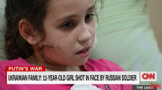 11-летней гимнастке из Мариуполя на блок-посте оккупанты выстрелили в лицо — CNN (видео)
