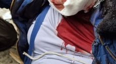 На Черниговщине сбили самолет и взяли одного пилота живым (фото, видео)