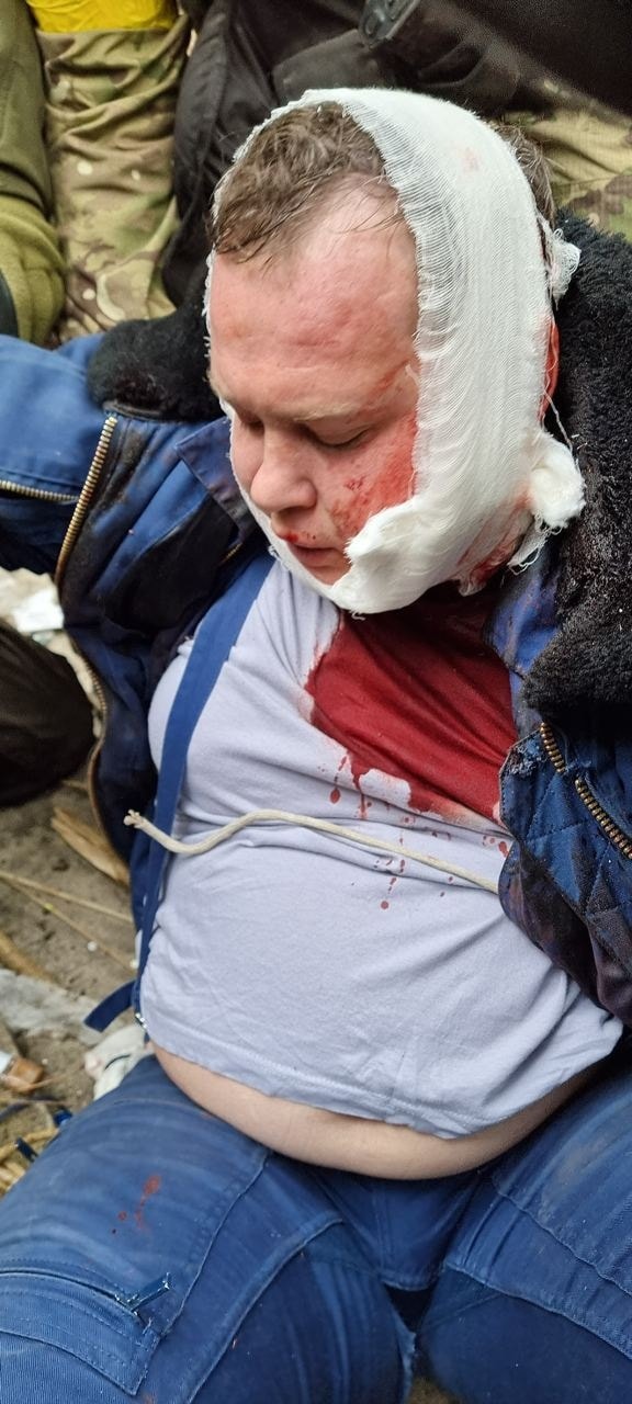 На Черниговщине сбили самолет и взяли одного пилота живым (фото, видео)