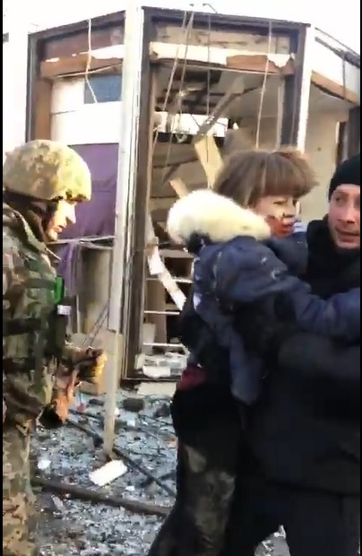 Девочку с Харьковщины, тяжело раненную из-за обстрела, перевели из реанимации