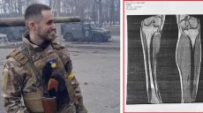 «Зачем ты оставлял ногу» — воин, раненый в Харькове, требует увольнений в МСЭК