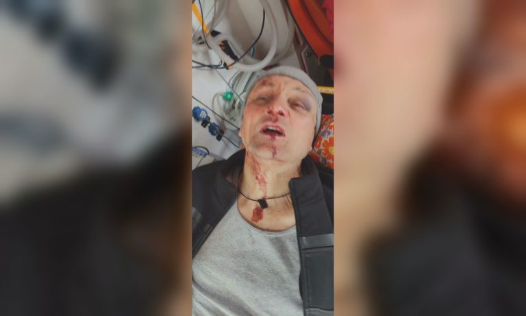 «Военные пытались избежать конфликта» — ОТЦК об избиении мужчины в Харькове