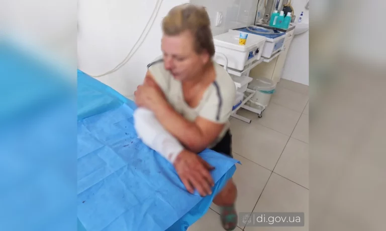 Подорвались, когда ехали домой за вещами: супруги ранены на Харьковщине